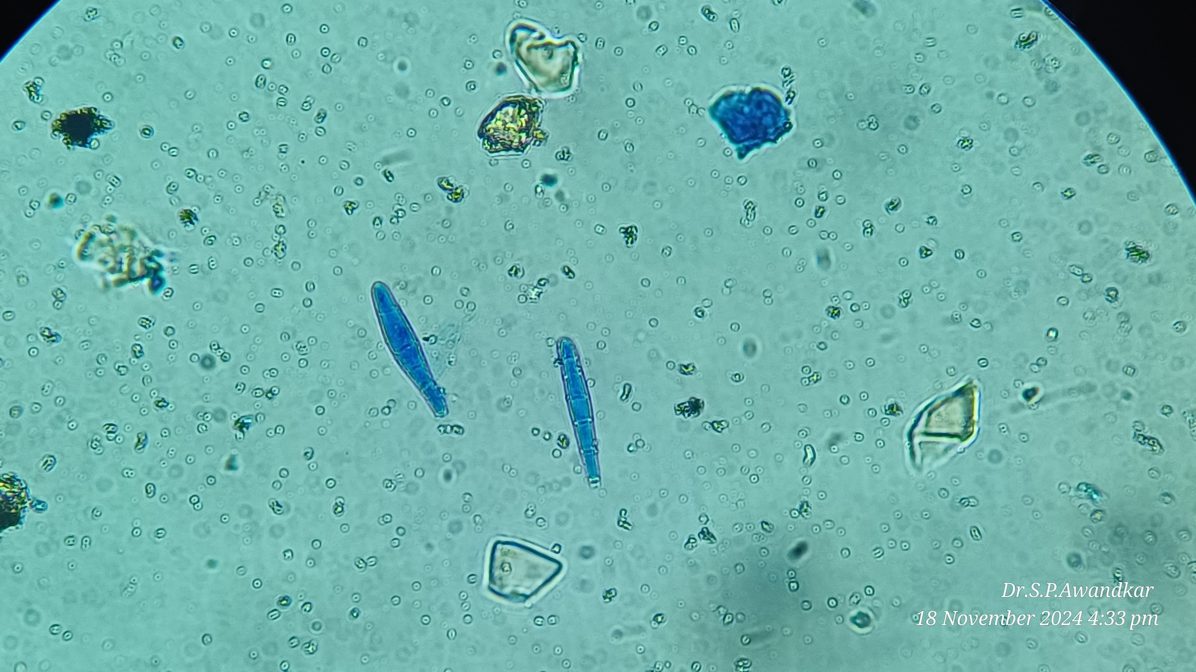 31. Trichophyton Mentagrophytes Macrospore